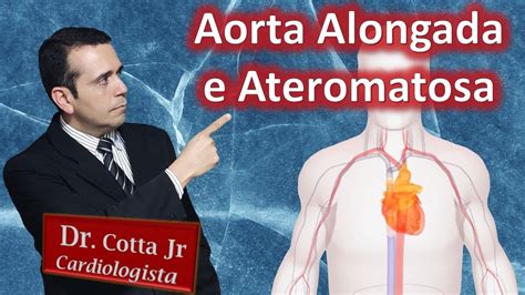 ateromatose da aorta